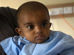 This 8-month-old needs a liver transplant to survive