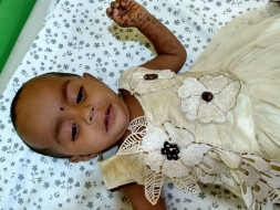 This Baby Has A Rare Birth Defect That Is Killing Her From Inside