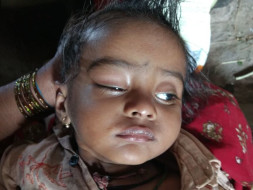 Help Baby Kiran Fight Against Blindness