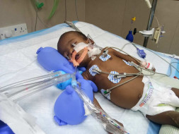 My 6-month-old Baby Has Been Fighting To Live Every Day
