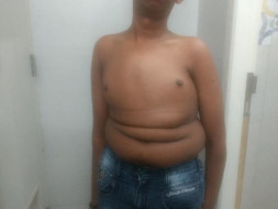 Help Shiva Fight His Spinal Cord Problem