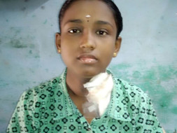 Support Sudhamathi to recover from End Stage Renal disease
