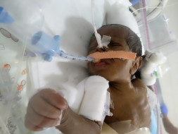Help Revathi save her baby boy born with a blocked intestine