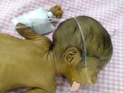 I Waited 13 Years To Be A Mother, Now My Twins Are Fighting To Live