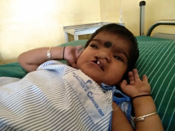 Help this 2-year-old fight heart disease