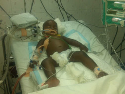 My Son has admitted due to sever Community acquired pneumonia