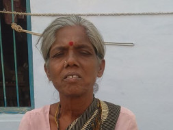 Help My Mother for ileal conduit urinary diversion Operation