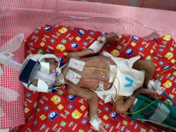 They Begged To Save Their Baby, But It Isn’t Enough To Save Her