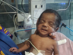 EMERGENCY-SAVE BABY FIGHTING AGAINST DEATH