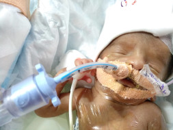 Help Stuti and Anurag save their premature baby boy
