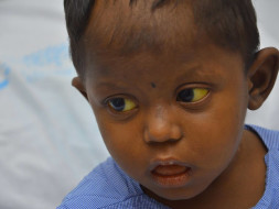 This 4-year-old Who Vomits And Poops Blood Is In Serious Danger