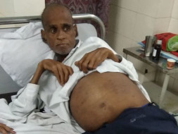 Need Financial Help For My Father's Treatment Of Kidney Failure