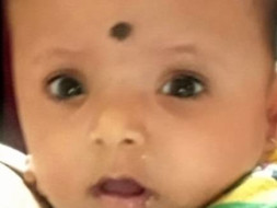 Help Prapti fight from Bicoronal Synostosis