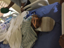 Urgent Help for mr sunil prajapat met with an accident on ventilator