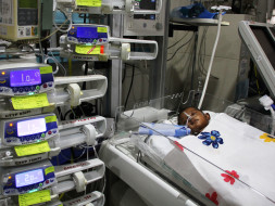 Her Oxygen Level Is Rapidly Dropping, This Baby Needs A Surgery Today