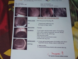 Help Us For The Surgery Of My Mother