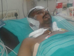 To Help 35 Year-Old to Recover from a Severe Accident Injury