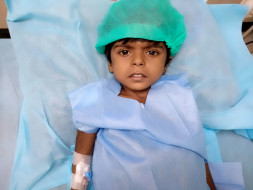 3-year-old Has Abnormal Fluid Collection In Her Stomach