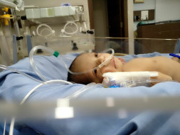 4-day-old Baby Will Suffocate To Death Unless He Has A Surgery