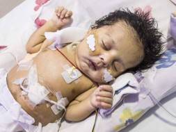 This Baby Boy Born Without Food Pipe Will Die Without Treatment