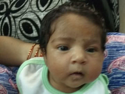 Help Baby Saara for Heart valves surgery