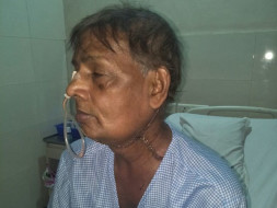 Help my father for fighting of tongue cancer