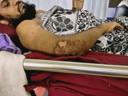 Help Adil Stand-up in Life!