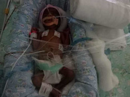 Help Shiva Save His 30 Day Old Premature Baby Girl.