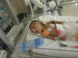 Help 3-month-old Manak fight heart disease