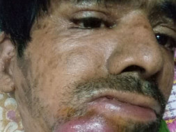 Help Sami Ulla Khan Fight Cancer