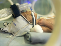 New Mother Has Not Seen Her 2-Month-Preemie Son As He Is In The ICU