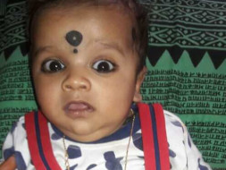 Kushal naga sai for bone marrow transplantation