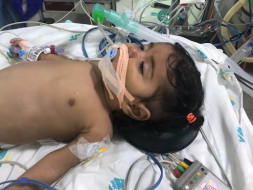 5-month-old Anjali has only 49% Oxygen Level, Needs Heart Surgery
