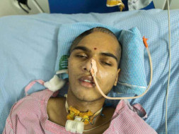 18-Year-Old's Skull is Partly Removed After Accident, Needs Surgery