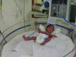 New Mother Goes Hungry Most Of The Time To Save Premature Twins
