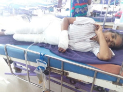 "Help Swarna fire accident" - She needs funds for medical expenses