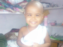 Nothing can restore a dead eye and this kid may lose another to cancer
