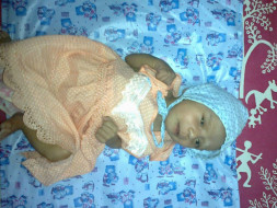 Help 4 Year Old Dnyanada Undergo Her Second Open Heart Surgery.
