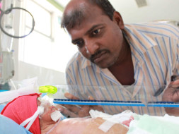 7-Day-Old Twins Need Help To Be Able To Breathe On Their Own And Live