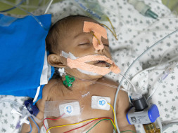 Savita's Newborn May Need A 3rd Surgery If He Cannot Get PICU Care