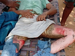 Help Ahmed Shaik Fight Against Serious Electric Shock