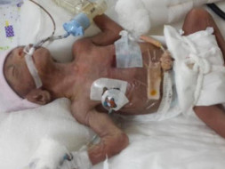 Help The Parents Save Their Young Lakshmi