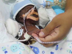Nurse's 20-day-old Baby Is Now Bleeding Into His Lungs And Needs Help