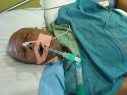Help My Father Fight Battles In The ICU