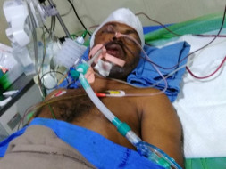 Help My Brother Who Is Undergoing For Brain Treatment