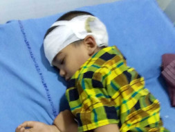 Help mahesh for brain surgery