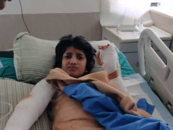 Help Sri Nithya Suffering From Severe Burn Injuries.