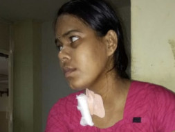 Help poornima get kidney transplanted