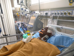 My only brother needs help- Kidney Failure & now brain bleed