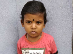 Help Aishnik For Cochlear Implant Surgery